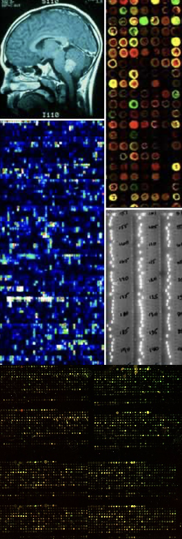 Epilepsy_researchCSKF